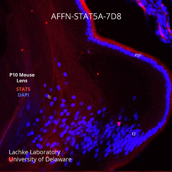 Stat5a antibody affn stat5a 7d8 dshb